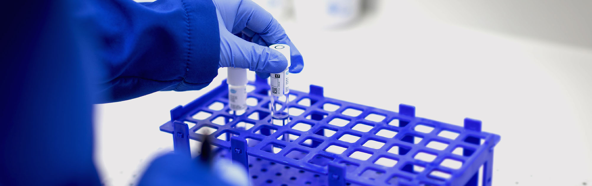 Close-up of a gloved hand placing a labeled test tube into a blue laboratory rack, with additional sample tubes visible in a bright clinical lab setting.